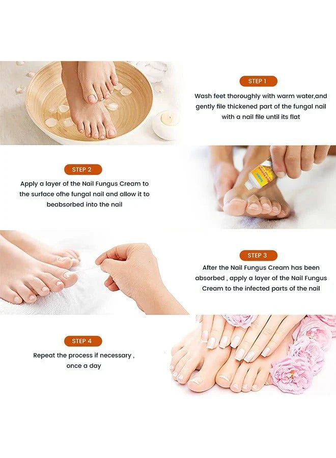 Sumifun - Bee Venom Fungal Nail Treatment Cream |  سوميفون - كريم سم النحل لعلاج فطريات الأظافر